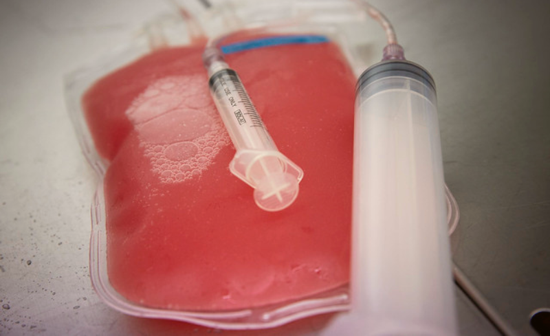 Banc de Sang i Teixits TMA Blood and Tissue Bank Gestión de residuos sanitarios Biosanitarios Transporte de residuos Sector salud Sector sanitario Sostenibilidad Healthcare waste Management Biomedical Waste Transportation Healthcare sector Health sector Sustainability Gestió de residus sanitaris Biosanitaris Transport de residus Sector salut Sector sanitari Sostenibilitat